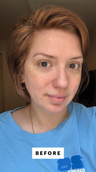 Kassidy Silva before applying ROZ Salt Scalp Scrub